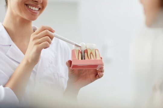 dental implants in Montreal